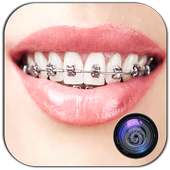 Braces Photo Editor Beauty on 9Apps