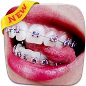 Braces Teeth Booth Pro on 9Apps