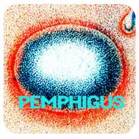 Pemphigus Disease on 9Apps