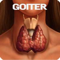 Goiter Disease on 9Apps