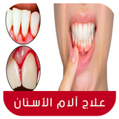 علاج ألم الأسنان طبيعيا‎ بدون نت - طرق مجربة أيقونة