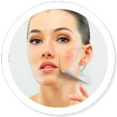 How to Get Rid of Acne icon