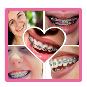 ikon Brace Selfie Beauty