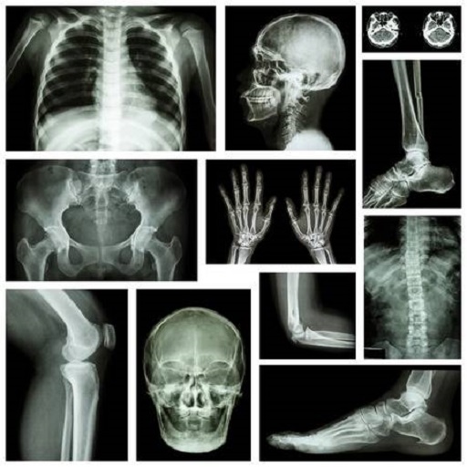 Medical X-RAY Interpretations with over 120  cases icon