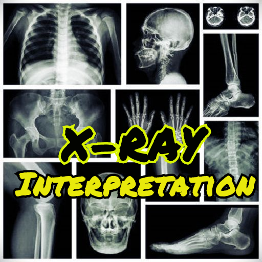 x-ray interpretation guide icon