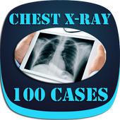 Interpret Chest X-Ray With 100 Cases icon