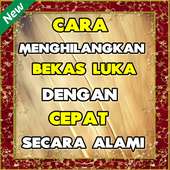 Cara Menghilangkan Bekas Luka dengan Secara Alami on 9Apps