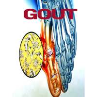 Gout Disease on 9Apps