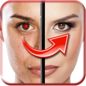 Red Eye Remover icon