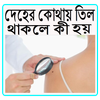 দেহের কোথায় তিল থাকলে কী হয় icon