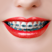 Behel Gigi - Braces Camera icon