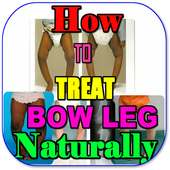 How To Fix Bow Legs Naturally on 9Apps