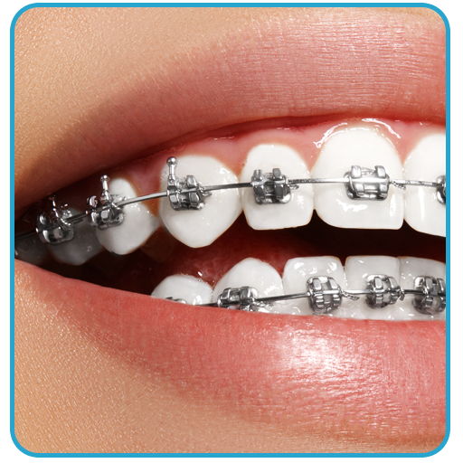Braces Photo Editor - Beauty editor icon