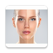 Acne Remover Photo Editor icon