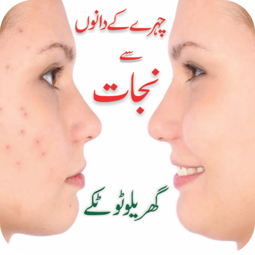 Face Pimples Home Remedy Solutions – Urdu Tips icon