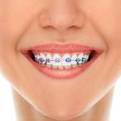 تركيب تقويم الأسنان on 9Apps