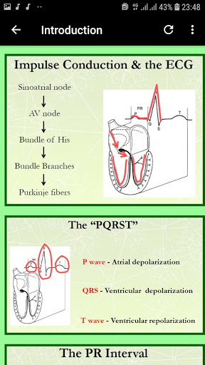 Clinical ECG Interpretation - GUIDE APP screenshot 5