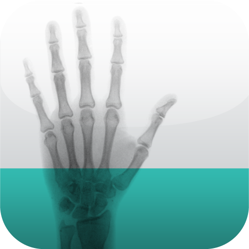 Bone Age Lite icon