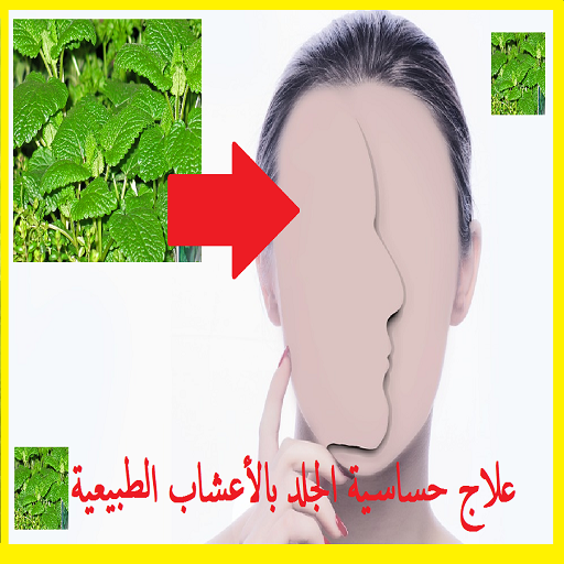 علاج حساسية الجلد بالأعشاب الطبيعية icon